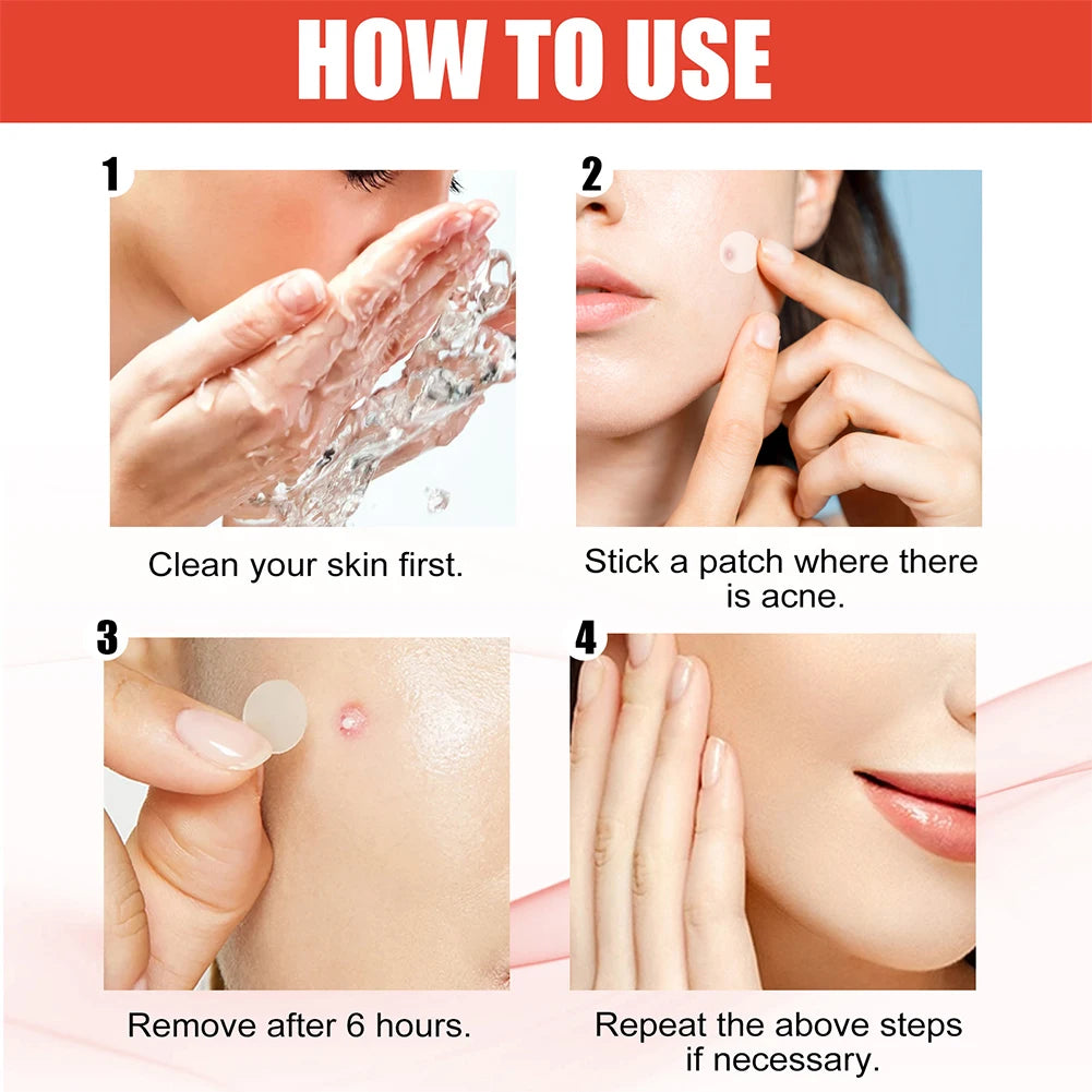 ClearDot™ 💧✨ – Invisible Acne Pimple Patch Set (144pcs for Men & Women)