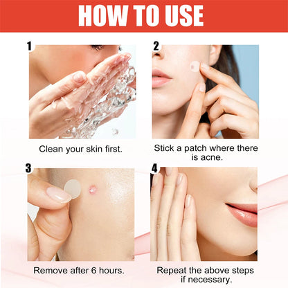 ClearDot™ 💧✨ – Invisible Acne Pimple Patch Set (144pcs for Men & Women)