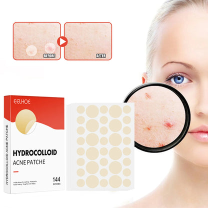 ClearDot™ 💧✨ – Invisible Acne Pimple Patch Set (144pcs for Men & Women)