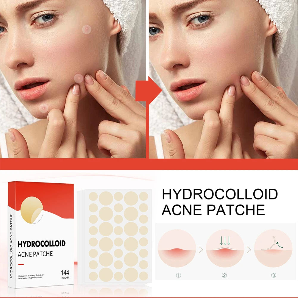 ClearDot™ 💧✨ – Invisible Acne Pimple Patch Set (144pcs for Men & Women)